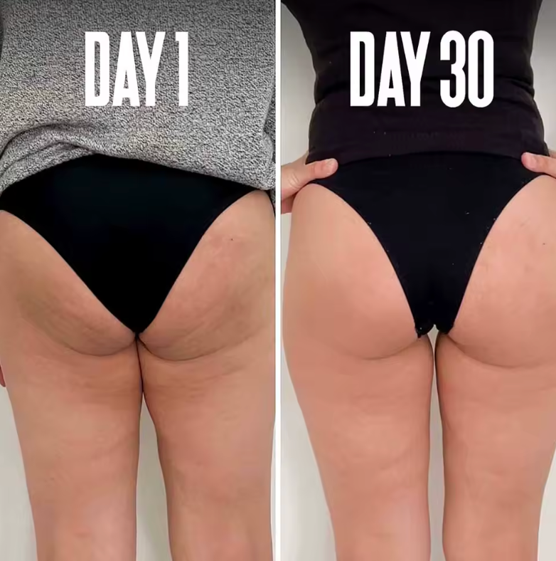 Peaché-Smooth™ Anti-Cellulite Cream